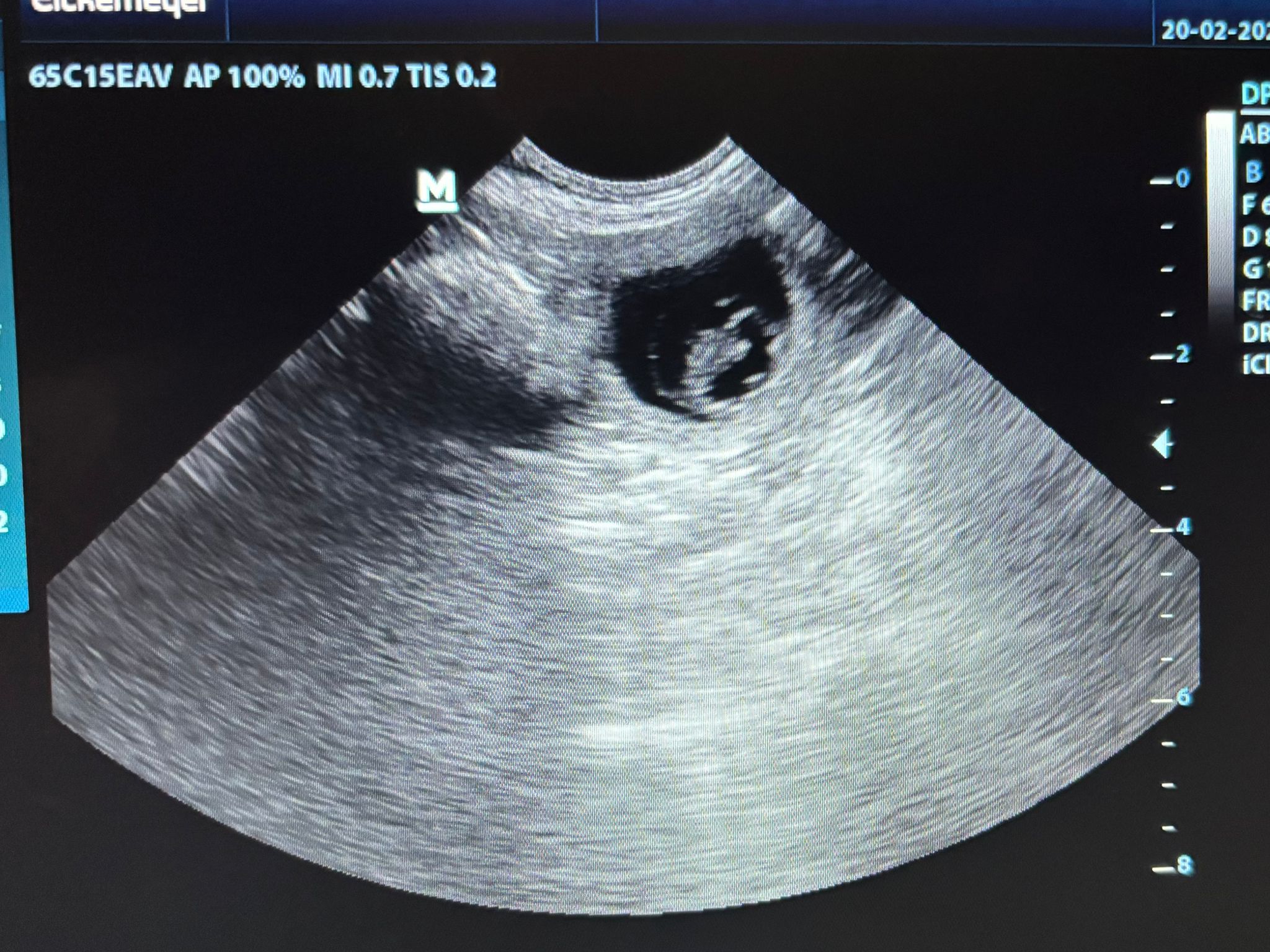 Ultraschall Welpen English Cocker Spaniel Maite vom Nikolausberg 19.2.2026